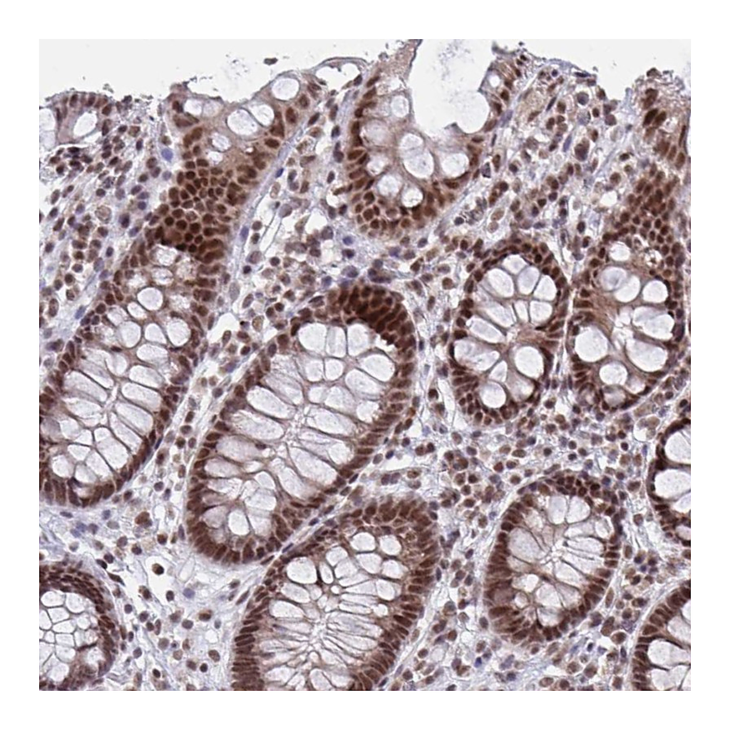Atlas Antibodies Anti-PHF10 Antibody