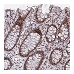 Atlas Antibodies Anti-PHF10 Antibody