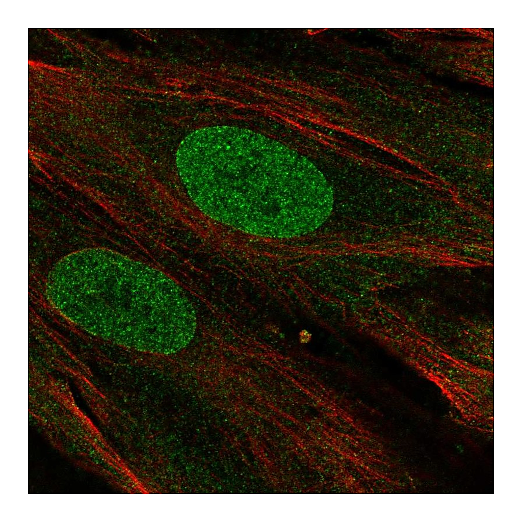 Atlas Antibodies Anti-PHF11 Antibody