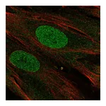 Atlas Antibodies Anti-PHF11 Antibody