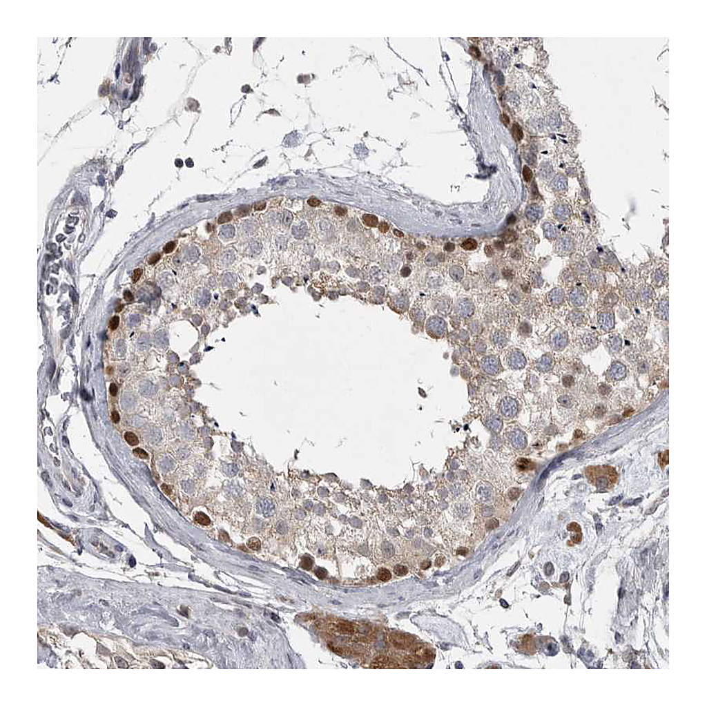 Atlas Antibodies Anti-PHF13 Antibody