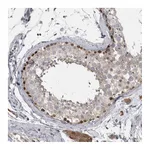 Atlas Antibodies Anti-PHF13 Antibody