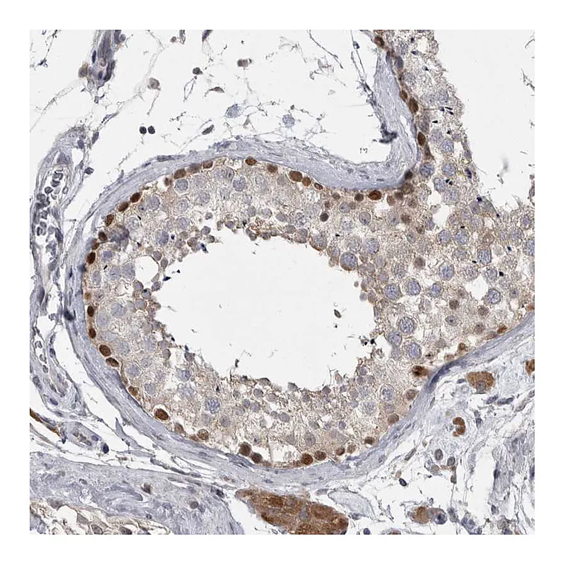 Atlas Antibodies Anti-PHF13 Antibody