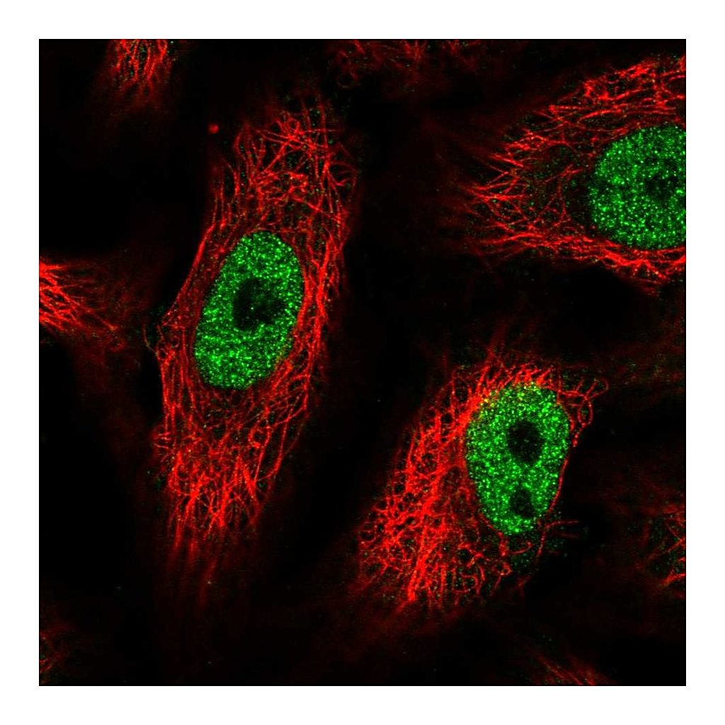 Atlas Antibodies Anti-PHF12 Antibody