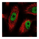 Atlas Antibodies Anti-PHF12 Antibody