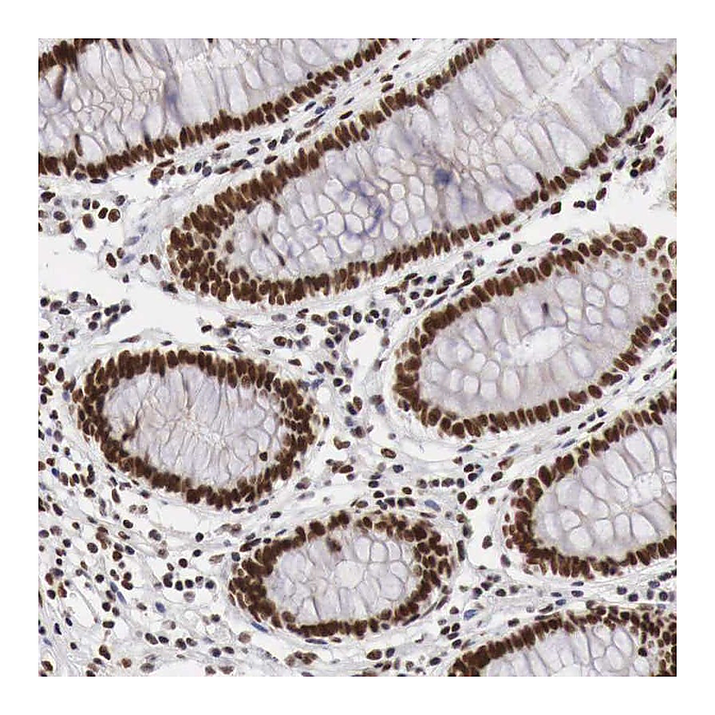 Atlas Antibodies Anti-PHF14 Antibody