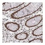 Atlas Antibodies Anti-PHF14 Antibody