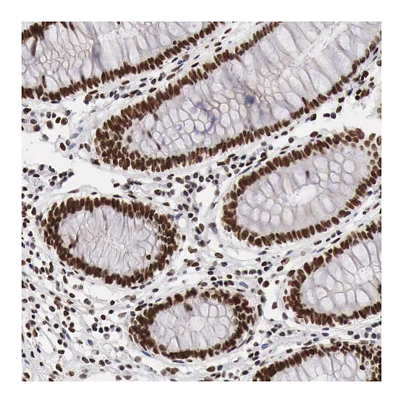 Atlas Antibodies Anti-PHF14 Antibody