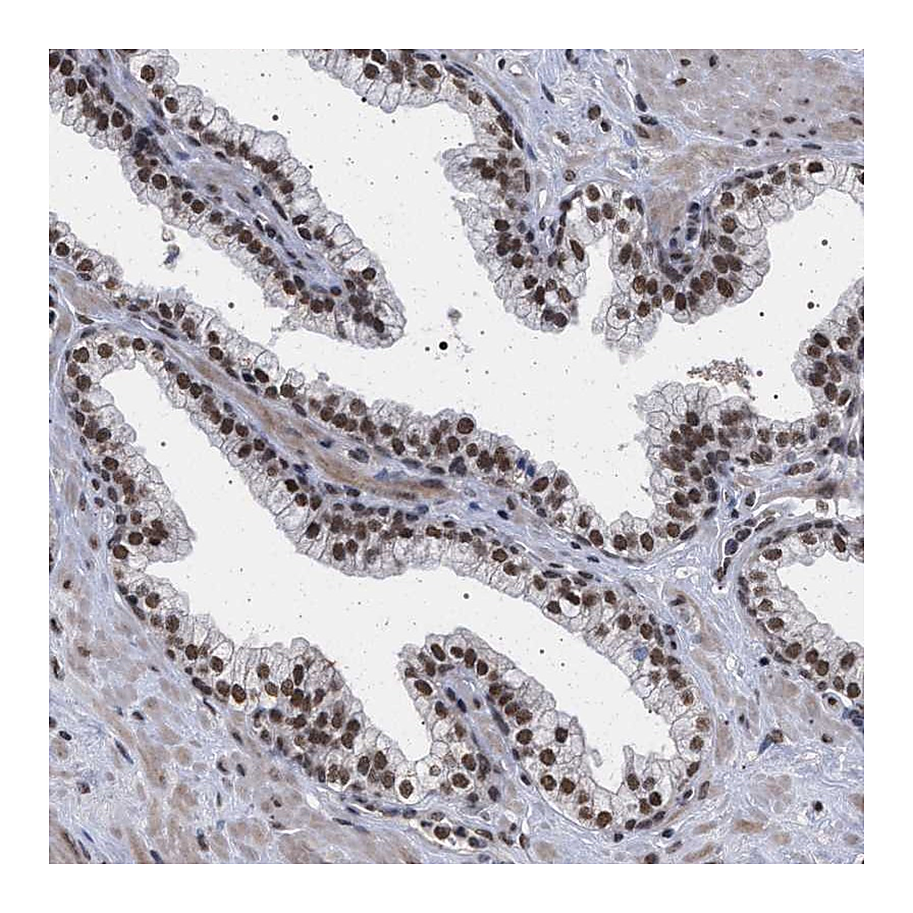Atlas Antibodies Anti-PHF12 Antibody