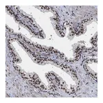 Atlas Antibodies Anti-PHF12 Antibody