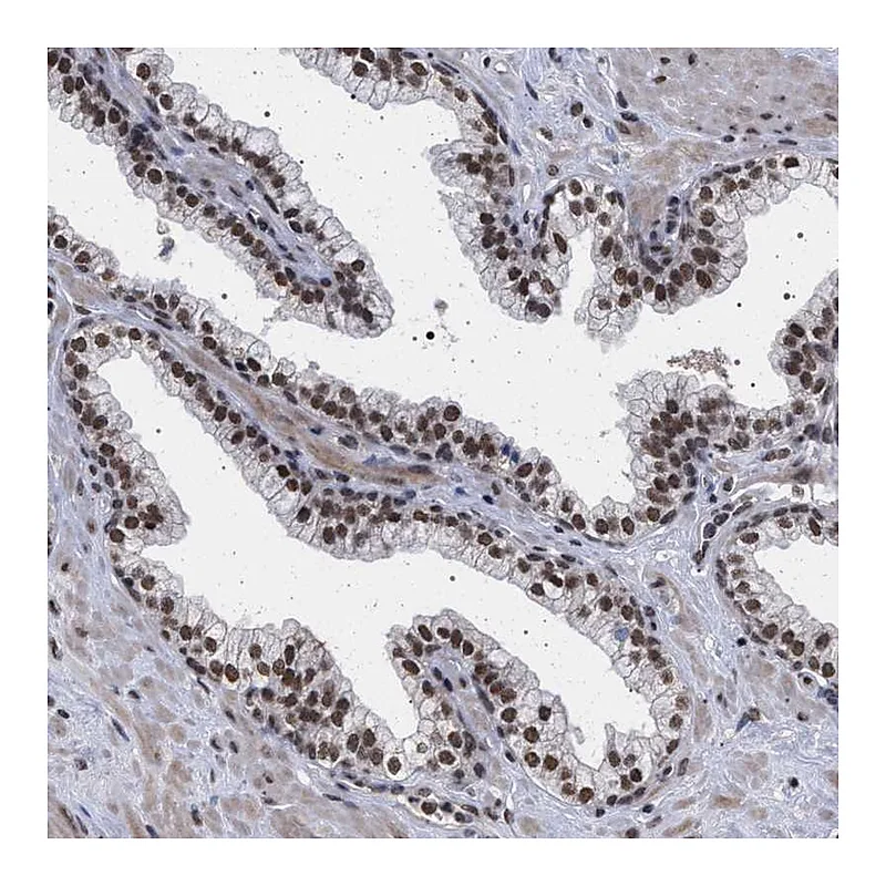 Atlas Antibodies Anti-PHF12 Antibody