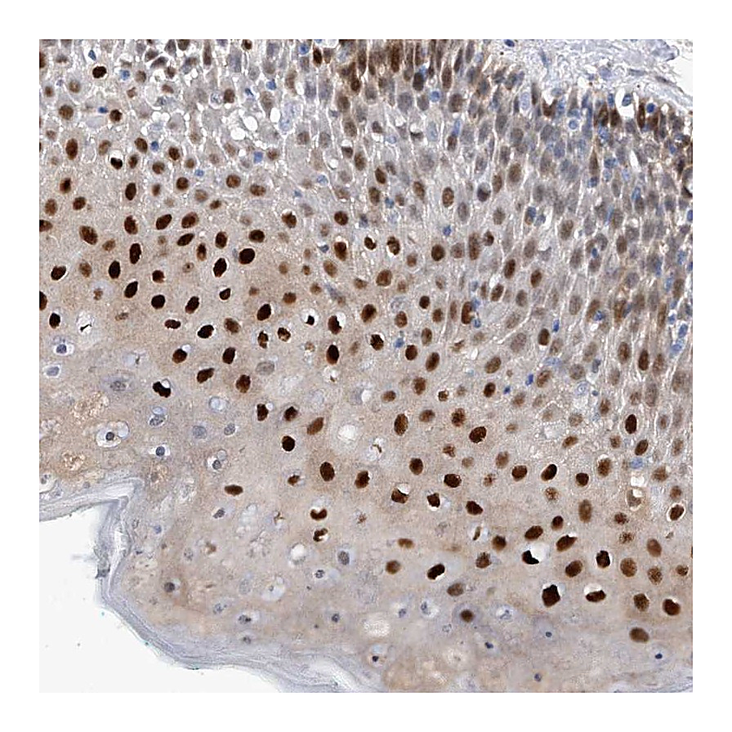 Atlas Antibodies Anti-PHF20 Antibody