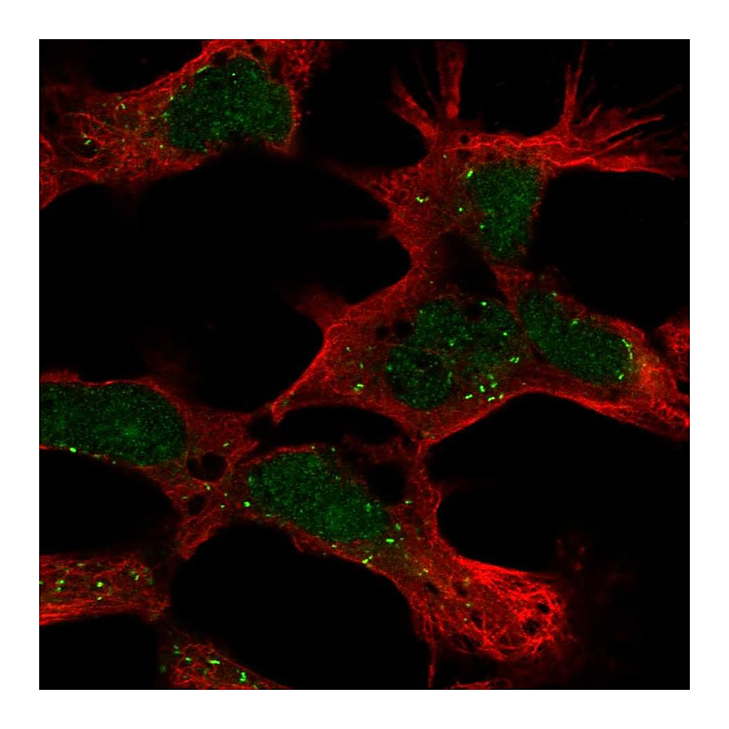 Atlas Antibodies Anti-PHF14 Antibody