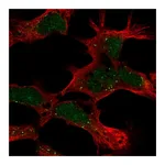 Atlas Antibodies Anti-PHF14 Antibody