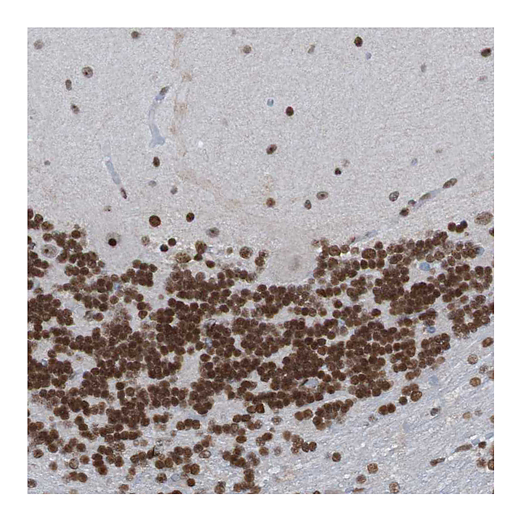 Atlas Antibodies Anti-PHF2 Antibody