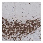 Atlas Antibodies Anti-PHF2 Antibody