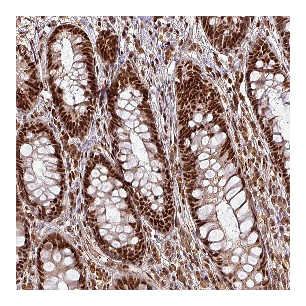 Atlas Antibodies Anti-PHF23 Antibody