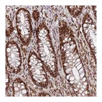 Atlas Antibodies Anti-PHF23 Antibody