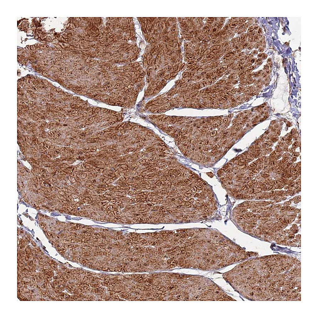 Atlas Antibodies Anti-PHF21A Antibody