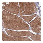 Atlas Antibodies Anti-PHF21A Antibody