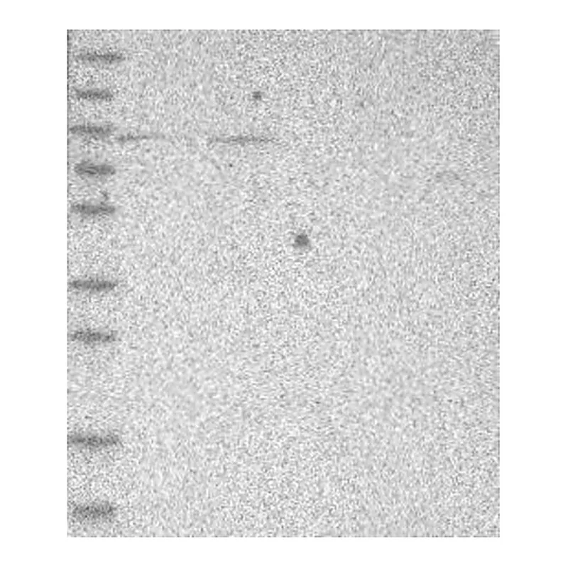 Atlas Antibodies Anti-PHF21A Antibody