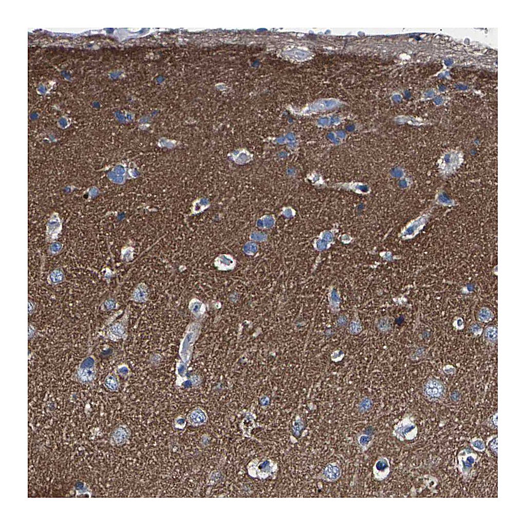 Atlas Antibodies Anti-PHF24 Antibody
