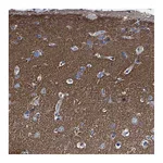 Atlas Antibodies Anti-PHF24 Antibody
