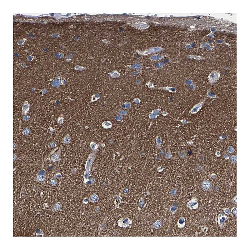 Atlas Antibodies Anti-PHF24 Antibody