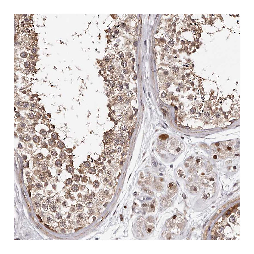 Atlas Antibodies Anti-PHF20L1 Antibody