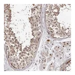 Atlas Antibodies Anti-PHF20L1 Antibody