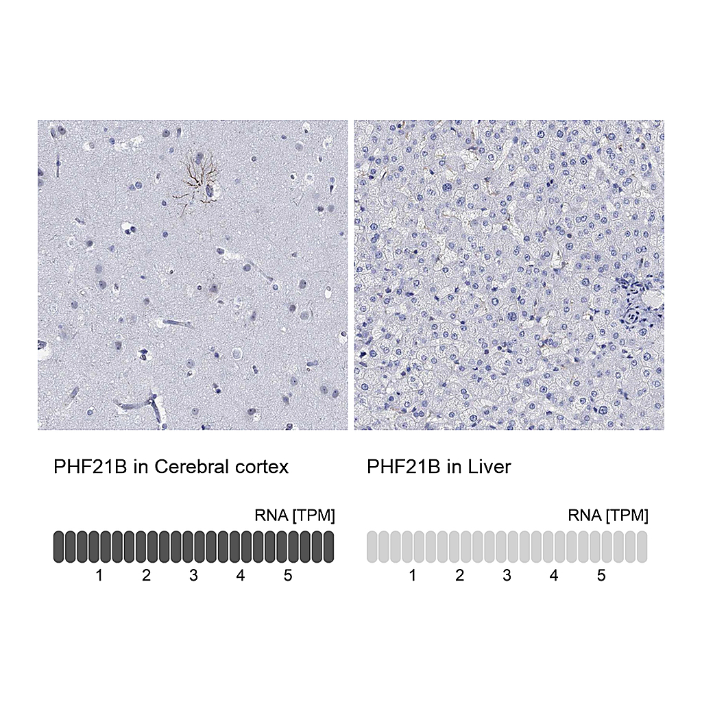 Atlas Antibodies Anti-PHF21B Antibody
