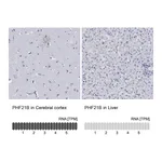 Atlas Antibodies Anti-PHF21B Antibody