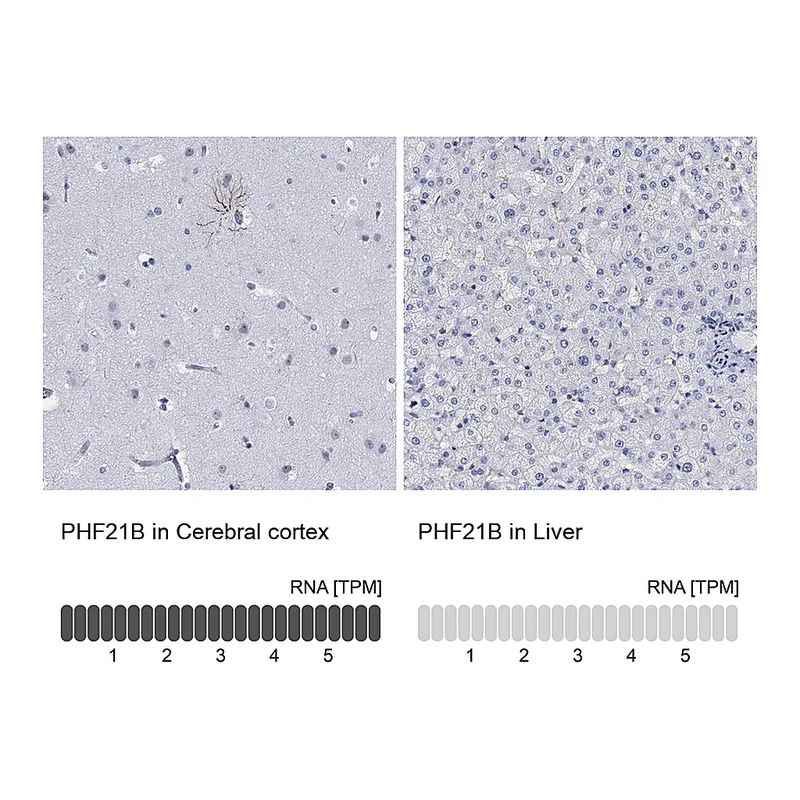 Atlas Antibodies Anti-PHF21B Antibody