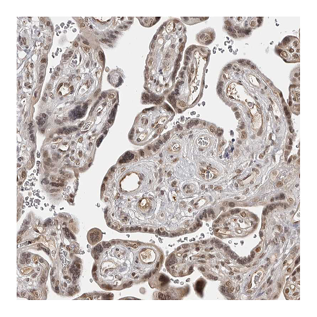 Atlas Antibodies Anti-PHF3 Antibody