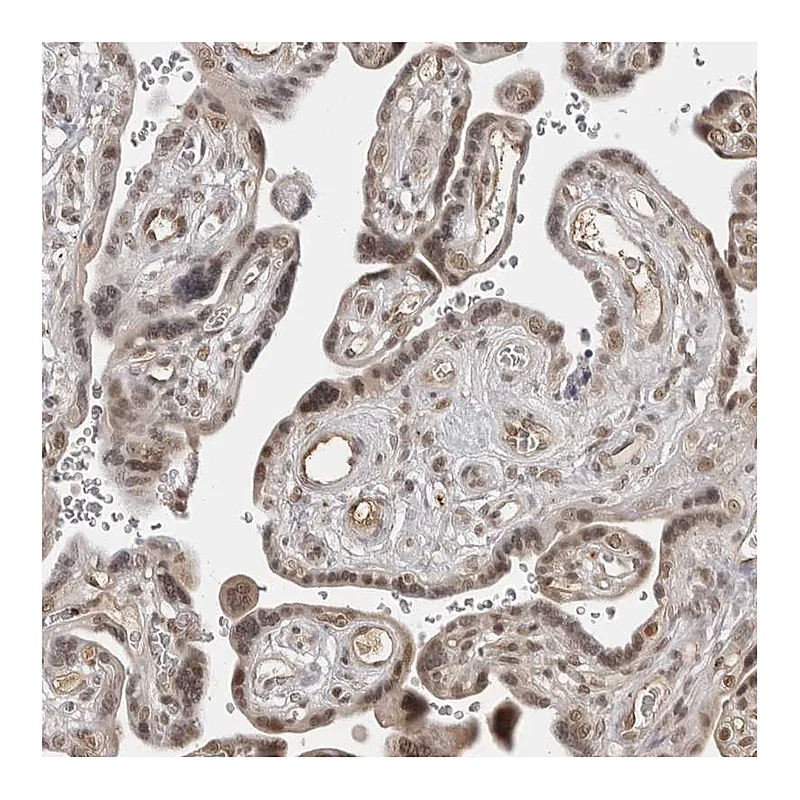 Atlas Antibodies Anti-PHF3 Antibody