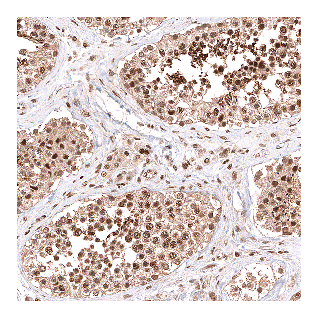 Atlas Antibodies Anti-PHF20L1 Antibody