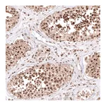 Atlas Antibodies Anti-PHF20L1 Antibody