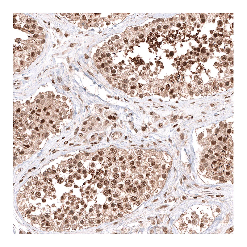 Atlas Antibodies Anti-PHF20L1 Antibody