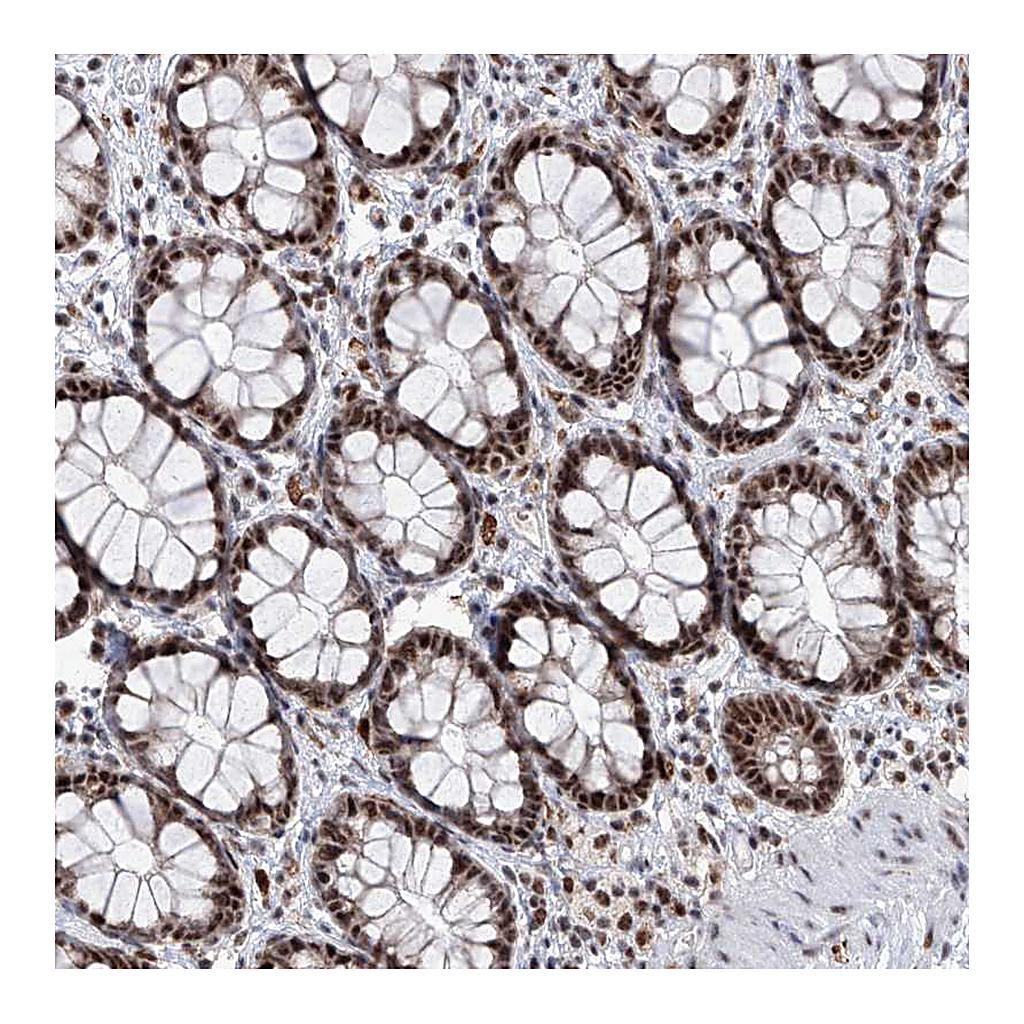 Atlas Antibodies Anti-PHF5A Antibody