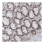 Atlas Antibodies Anti-PHF5A Antibody