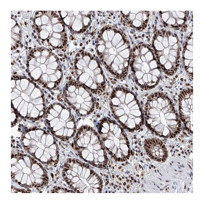 Atlas Antibodies Anti-PHF5A Antibody