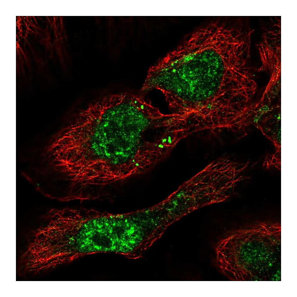 Atlas Antibodies Anti-PHF7 Antibody