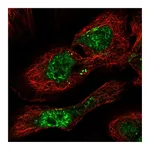 Atlas Antibodies Anti-PHF7 Antibody