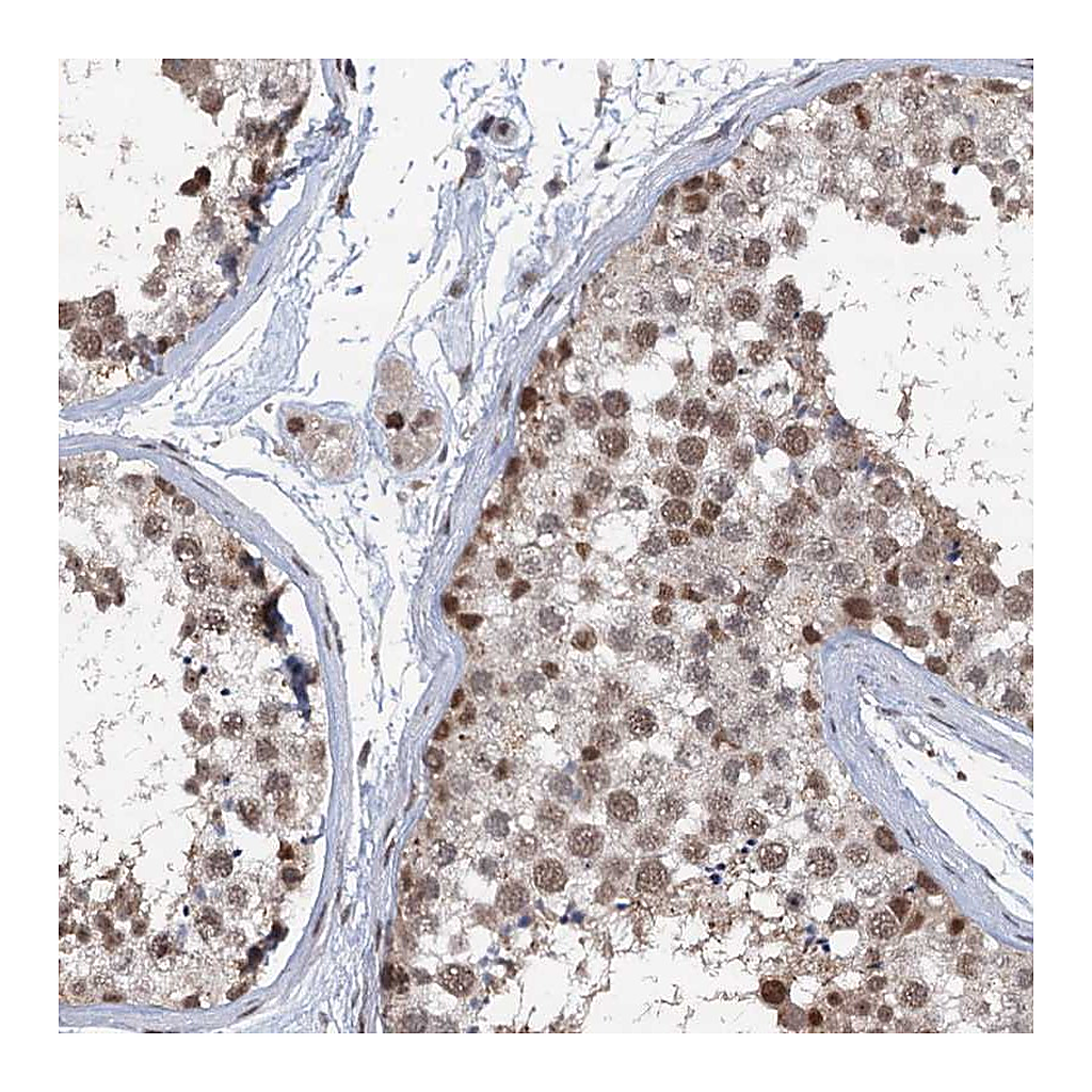 Atlas Antibodies Anti-PHF8 Antibody