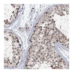 Atlas Antibodies Anti-PHF8 Antibody