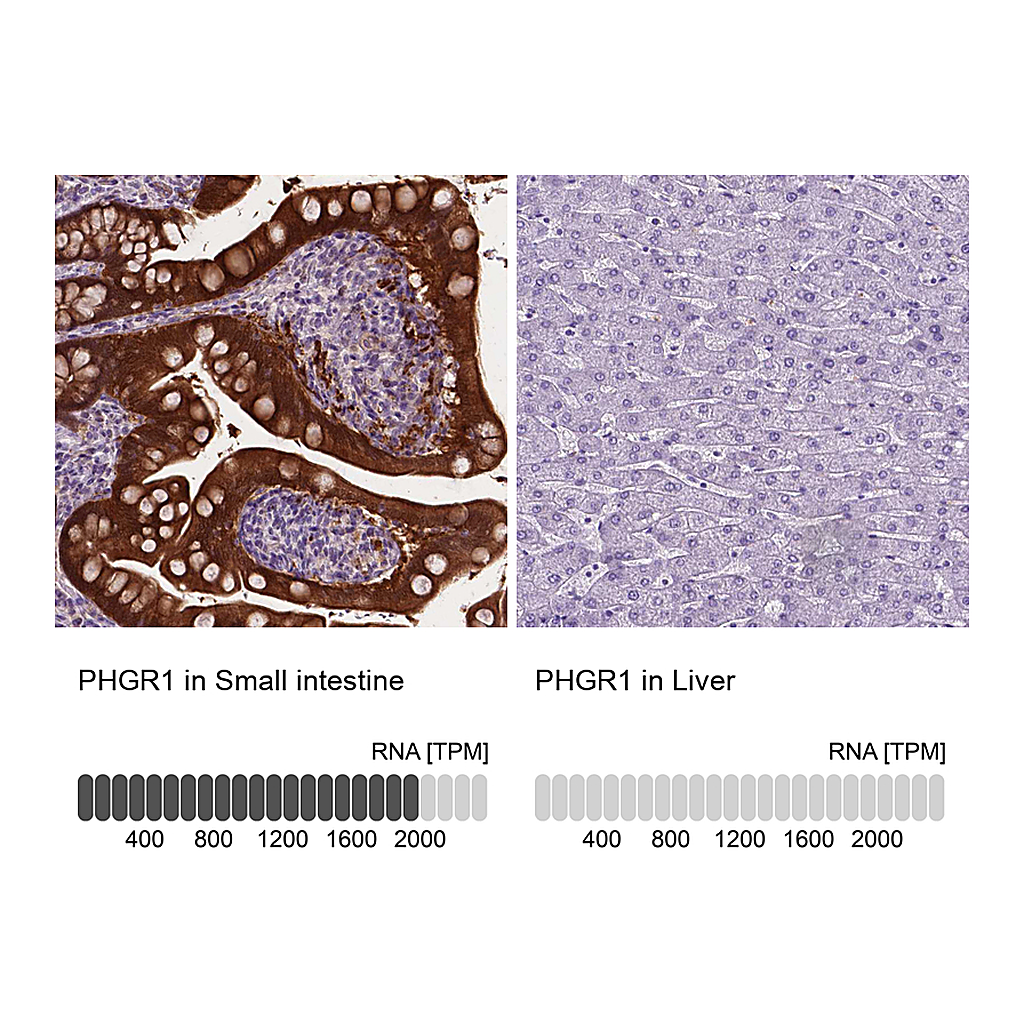 Atlas Antibodies Anti-PHGR1 Antibody