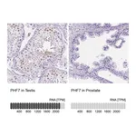 Atlas Antibodies Anti-PHF7 Antibody