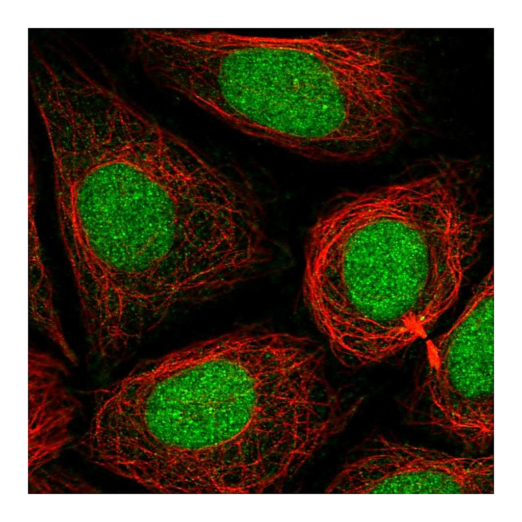 Atlas Antibodies Anti-PHF8 Antibody