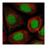 Atlas Antibodies Anti-PHF8 Antibody