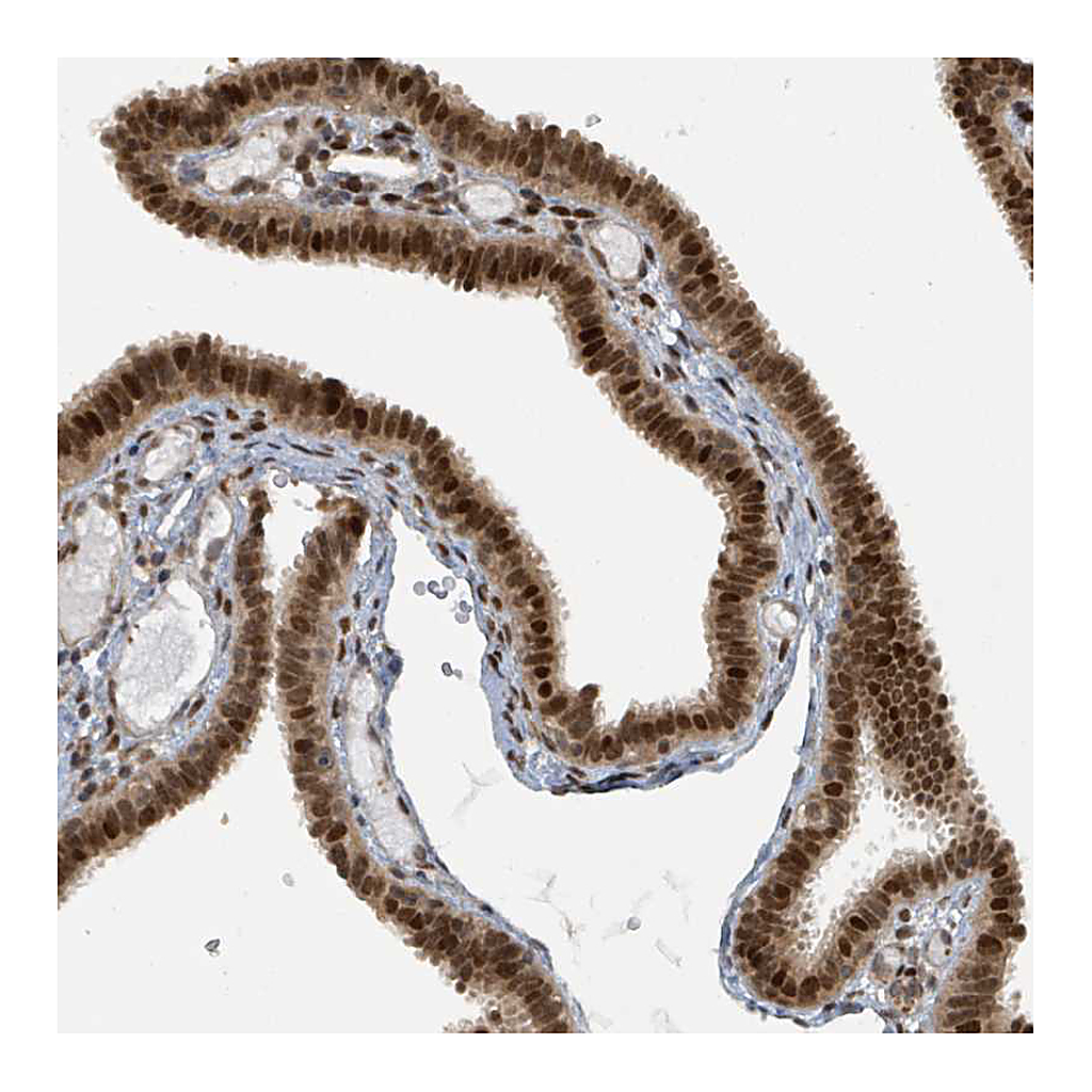 Atlas Antibodies Anti-PHIP Antibody